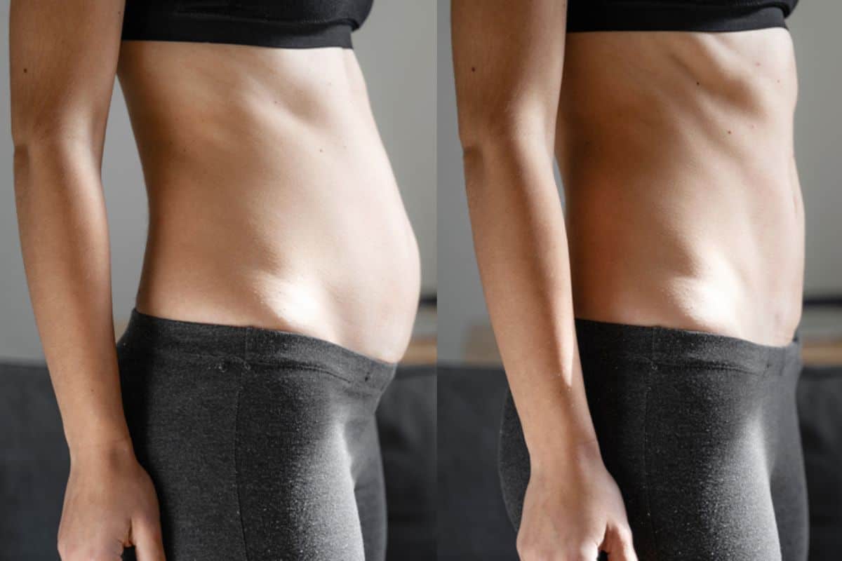 Post-Pregnancy: What Happens to Your Abdominal Muscles After Birth Hemel Hempstead