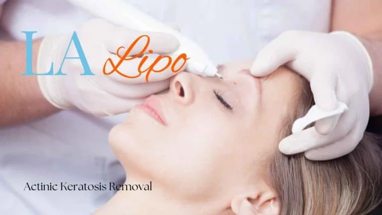Woman receiving Actinic Keratosis Removal Treatment Hemel Hempstead