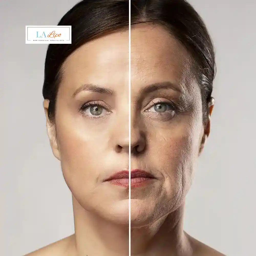 How Can You Tell If Non-Surgical Skin Tightening Is Right for You Hemel Hempstead?