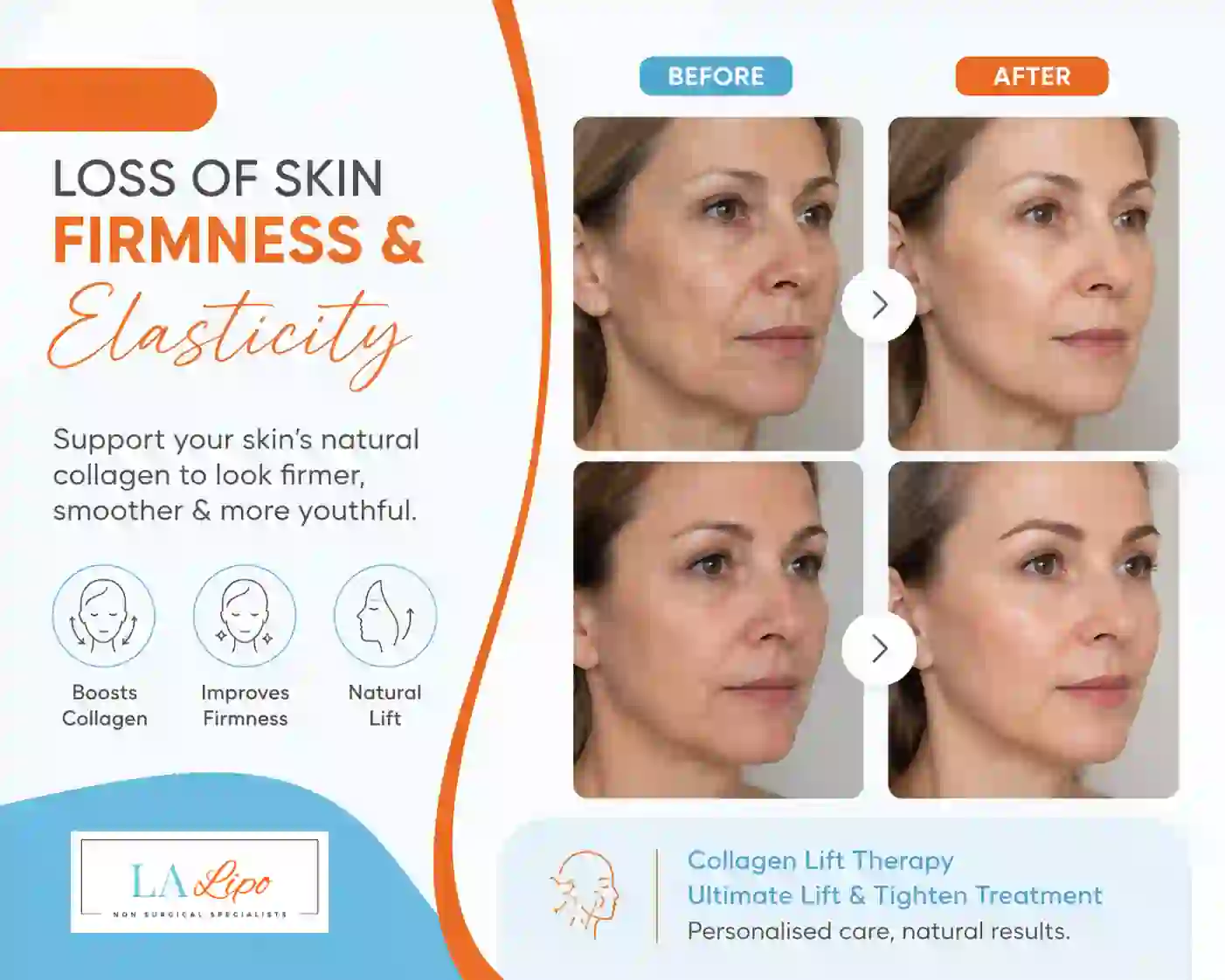 Sign #7: Loss of Skin Firmness and Elasticity Hemel Hempstead