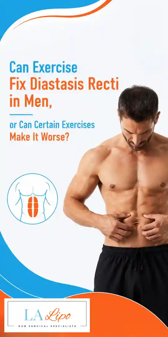 Can Exercise Fix Diastasis Recti in Men, or Can Certain Exercises Make It Worse Hemel Hempstead?