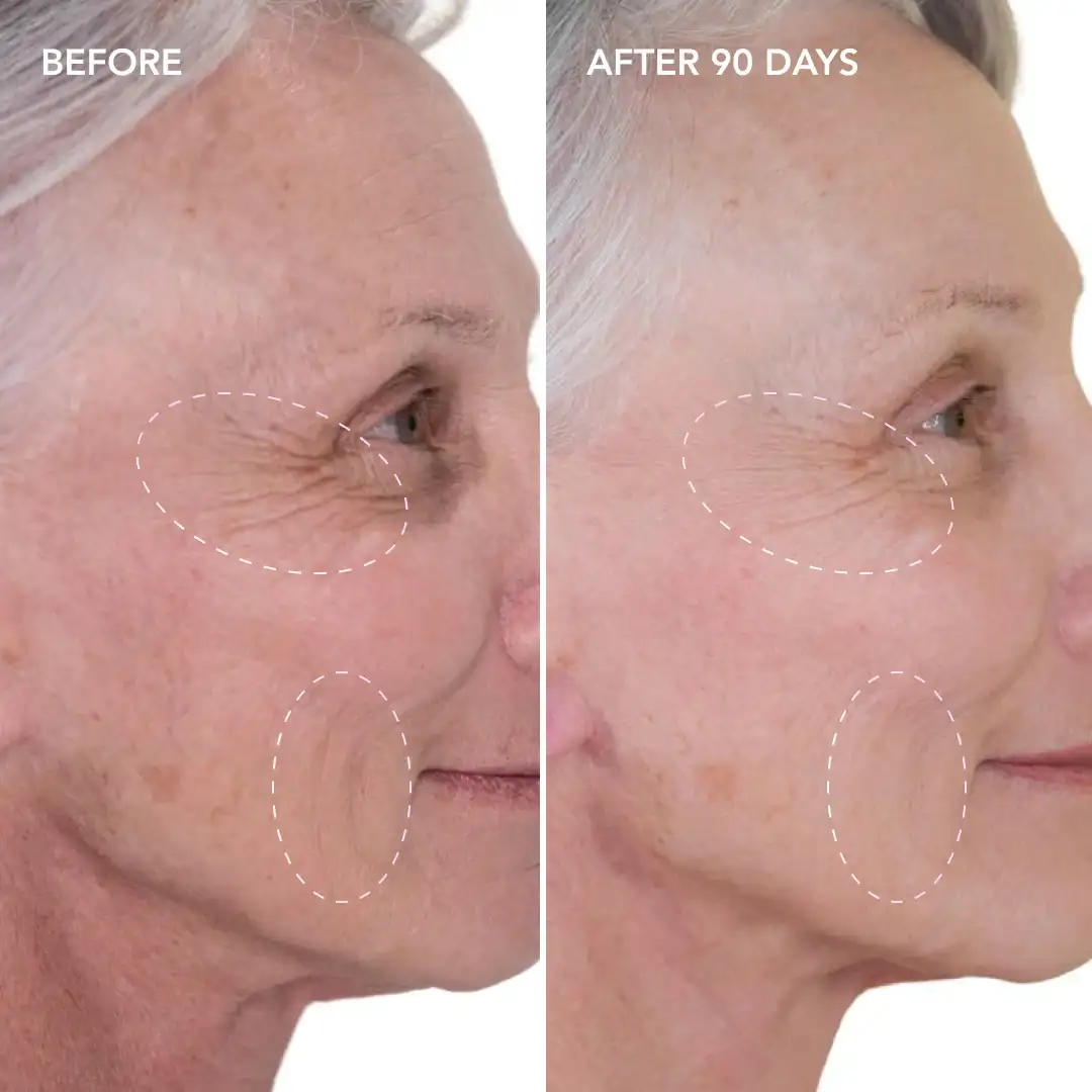 When will you see results Hemel Hempstead